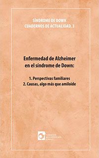 Sindrome-de-downcuaderno-actualidad3 Enfermedad de Alzheimer en el síndrome de Down